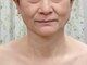 目元 口元のたるみ 眉間シワ改善専門サロンの写真/代謝が不安定になり浮腫みが酷くなりがち。全ての小顔になりたい人の願いを40分で叶える技術！