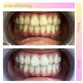 エクシアホワイトニング 稲沢店