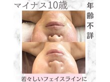 ビューティーツリー(Beauty Tree)