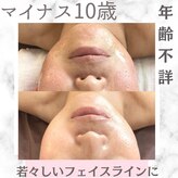 ビューティーツリー(Beauty Tree)