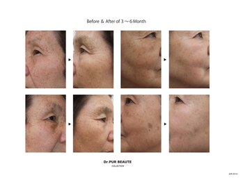 ルポ(RUPO)/Dr．PUR BEAUTE化粧品