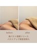 背中筋膜リリース×導入柔らか美バストケア