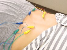 ビッグハンド/鍼灸