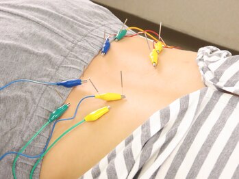 ビッグハンド/鍼灸