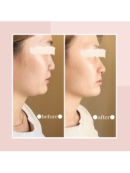 ボン セジュール(Bon sejour)/レモンボトル