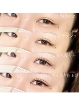 クレー(Klee)/アンドヘルシー