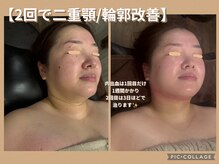 ボディリカバリー(Bodyリカバリー)/