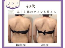 リュミエール(Lumiere)/【症例】究極のリンパマッサージ