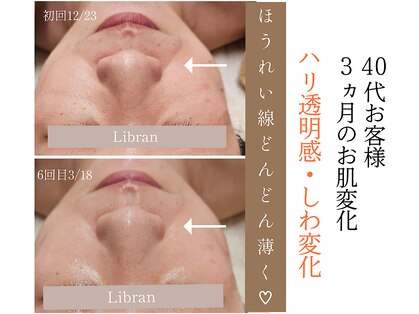 リブラン(Libran)の写真