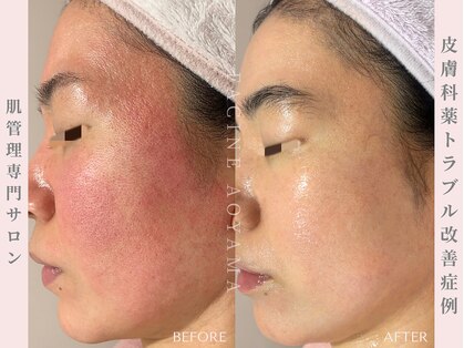 ファシネアオヤマ(FACINE AOYAMA)の写真