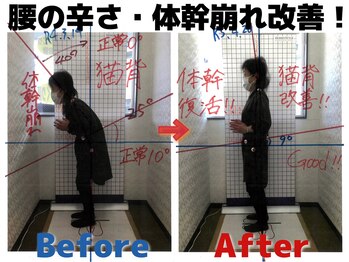 ほねくま整体院 ほねくま接骨院・はりきゅう院 泉中央本院/施術のbefore after