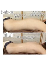 メルシートータルビューティー(MERCI)/オイルリンパ