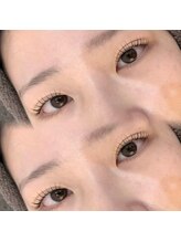 ネオリーブ ウリ(Neolive uri)/パリジェンヌラッシュリフト