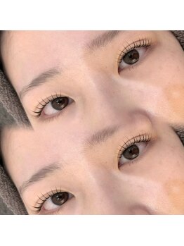 ネオリーブ ウリ(Neolive uri)/パリジェンヌラッシュリフト