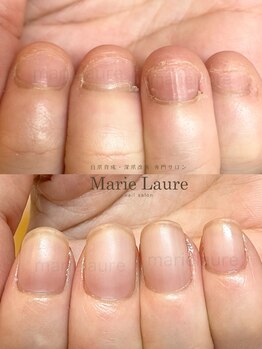 マリーロール 淀屋橋本店(Marie Laure)/深爪矯正/自爪育成/ネイルケア