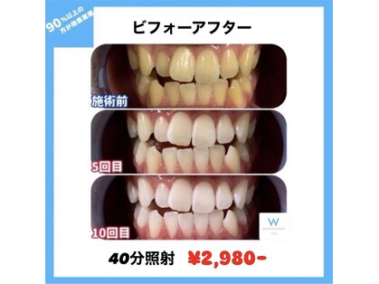 ホワイトニングショップ 米子店の写真