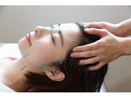 センコウ(SENKOU)の写真