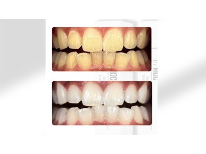 LUCE WHITE【セルフホワイトニングサロン/室蘭登別】の写真