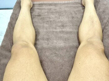 【脱毛サロン】ミセレル大村店の写真/【V・ファーレン長崎選手も通う脱毛サロン★】顔・VIO込みの超全身脱毛が大人気！都度払い制あり◎