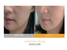 クレセント(crescent)/”美白ケア”は光彩美白管理