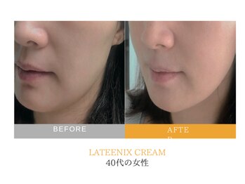 クレセント(crescent)/”美白ケア”は光彩美白管理