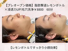 頭のオアシすぱ