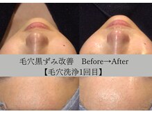 ラリマ グラマラス(Larima Glamorous)/1回目はお掃除、2回目からが本番