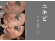 ラヴニール(L'avenir)