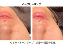 エルヴェ(Eleve)/回数を重ねて土台を整える