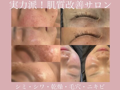 リリー(LILLY)の写真