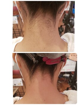 プトゥリ(Putri)/うなじWax脱毛で綺麗な後ろ姿