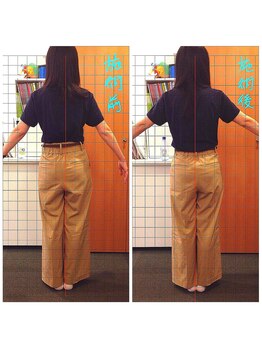 さらさ整骨院/産後骨盤矯正ビフォーアフター