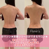プルメリア(Plumer’a)