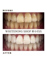 ホワイトニングショップ 新小岩店/歯科提携　ホワイトニング専門店