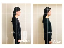 イカル 池袋(ikaru)の雰囲気（全身美容整体のbefore afterです）