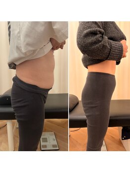 ナオ接骨院(NAO接骨院)/Before/After