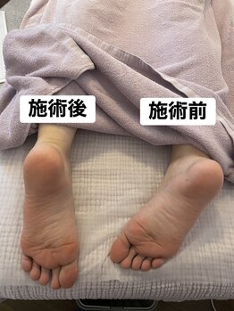 ヨギート(yogate)/リンパマッサージ/小顔/ヘッド