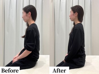 ソレア(Solea)/肩甲骨・巻き肩改善1回目