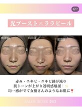サロン 稲(SALON IIIINEE)/光ブースト
