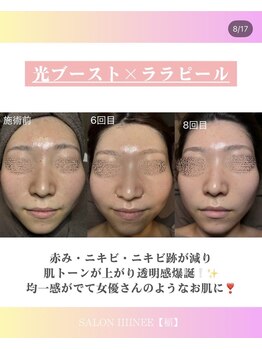サロン 稲(SALON IIIINEE)/光ブースト
