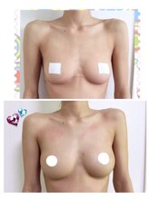 ビューティースリム タニダ/バストアップ