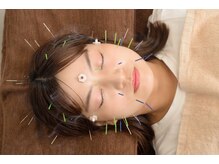 マーキュリー(Mercury)/美容鍼灸