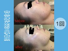 ポラリス(Polaris)/