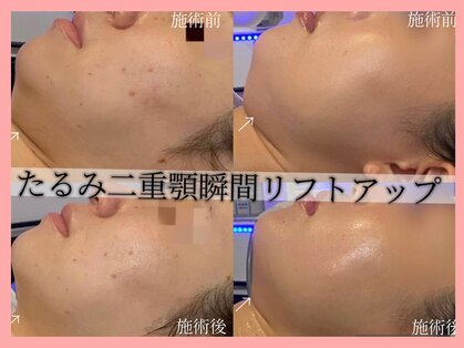 ハイフン(HIFUN)の写真