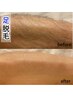 【新規】足or腕脱毛