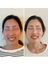 アガルコガオサロン(AGARU KOGAO SALON)/