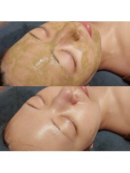 マイフェアレディ 今池(MyFairLady)/人気★毛穴洗浄ハーブピーリング