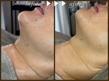 ビーエルティー(blt)/レモンボトル