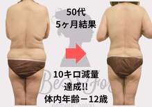 ビーフォー(be for)