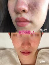 ユミ 町田鶴川店/話題LDM